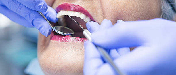 Best Emergency Dentist for Lost Fillings or Crowns in Woodbine, IA